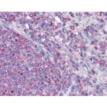 Immunohistochemistry - Actin antibody from Signalway Antibody (22959) - Antibodies.com