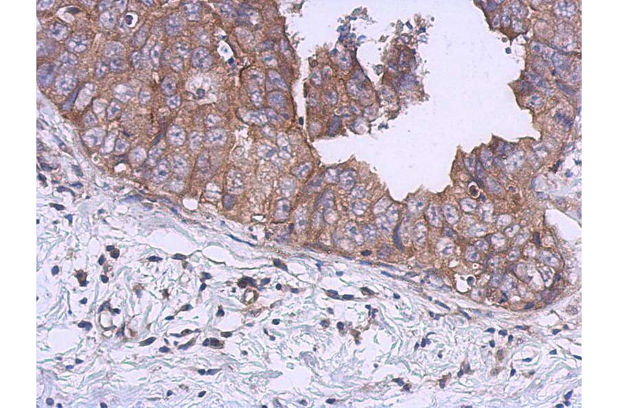 Immunohistochemistry - UKHC antibody from Signalway Antibody (23030) - Antibodies.com