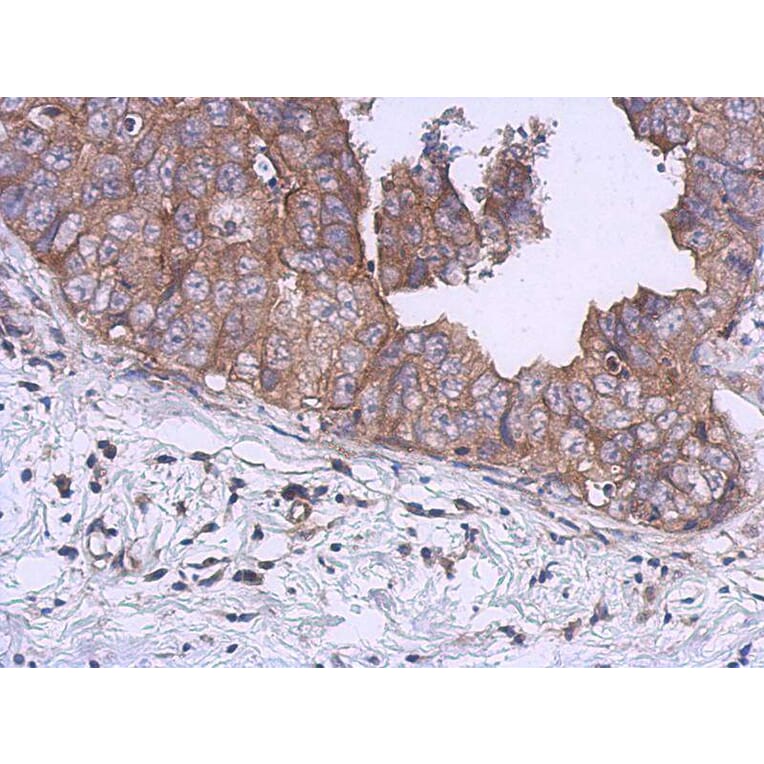 Immunohistochemistry - UKHC antibody from Signalway Antibody (23030) - Antibodies.com