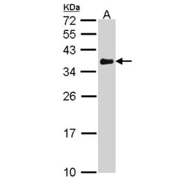 VDAC1 antibody from Signalway Antibody (23076) - Antibodies.com