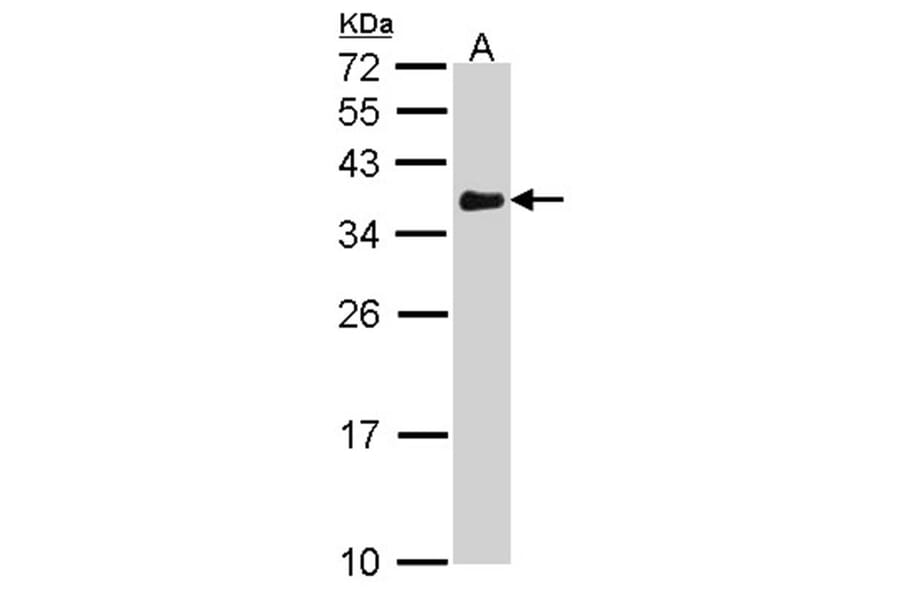 VDAC1 antibody from Signalway Antibody (23076) - Antibodies.com