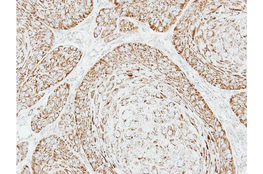 Immunohistochemistry - VDAC1 antibody from Signalway Antibody (23076) - Antibodies.com