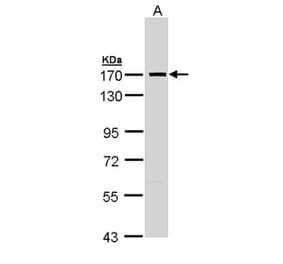 SMC1A antibody from Signalway Antibody (23082) - Antibodies.com