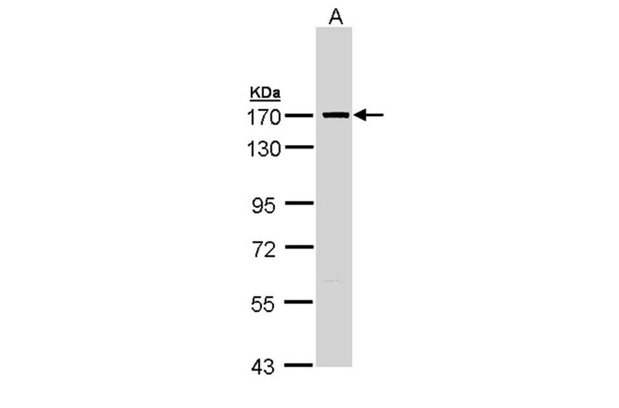 SMC1A antibody from Signalway Antibody (23082) - Antibodies.com