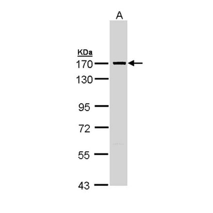 SMC1A antibody from Signalway Antibody (23082) - Antibodies.com