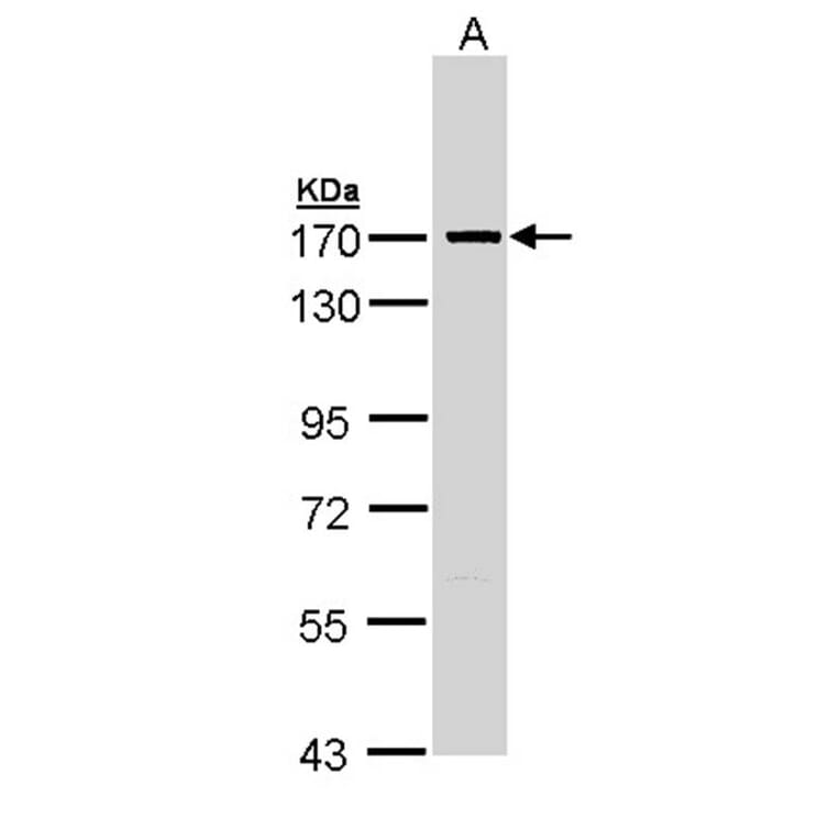 SMC1A antibody from Signalway Antibody (23082) - Antibodies.com
