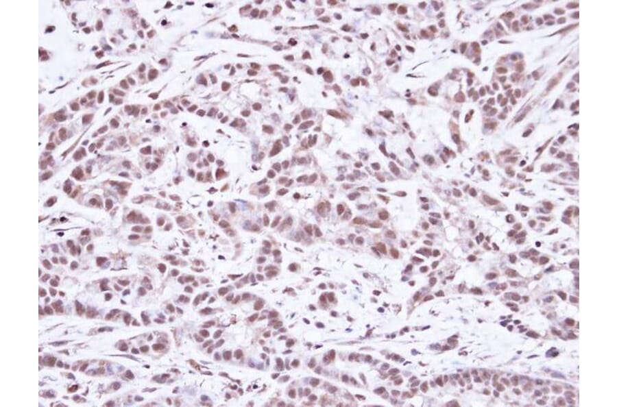 Immunohistochemistry - SMC1A antibody from Signalway Antibody (23082) - Antibodies.com
