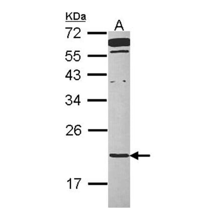 TMED2 antibody from Signalway Antibody (23111) - Antibodies.com