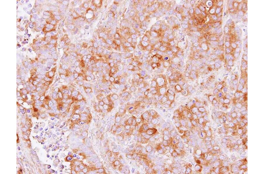 Immunohistochemistry - TMED2 antibody from Signalway Antibody (23111) - Antibodies.com