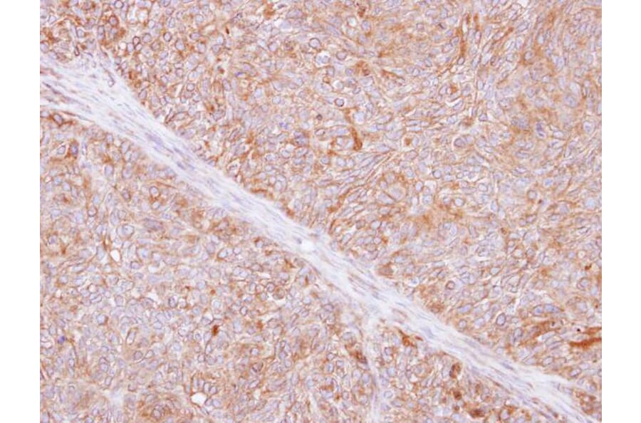 Immunohistochemistry - TMED9 antibody from Signalway Antibody (23133) - Antibodies.com