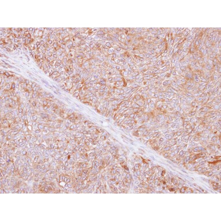 Immunohistochemistry - TMED9 antibody from Signalway Antibody (23133) - Antibodies.com