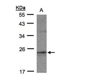 RAP2C antibody from Signalway Antibody (23146) - Antibodies.com