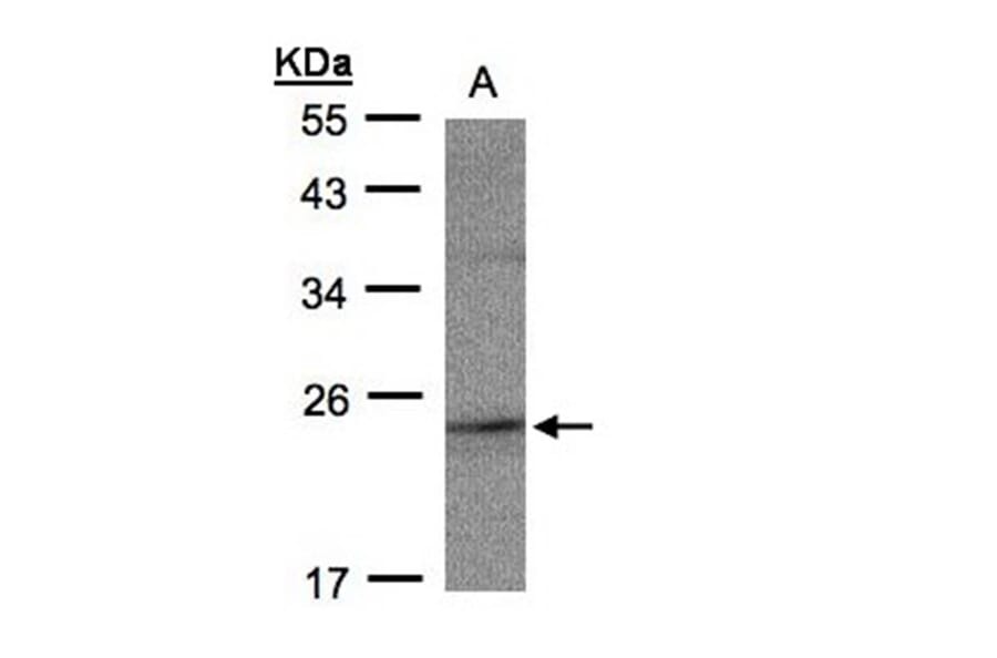 RAP2C antibody from Signalway Antibody (23146) - Antibodies.com