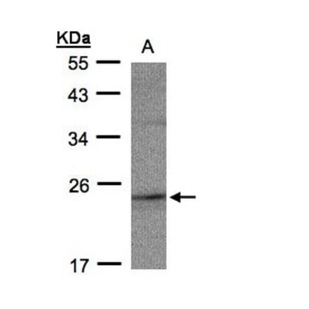 RAP2C antibody from Signalway Antibody (23146) - Antibodies.com