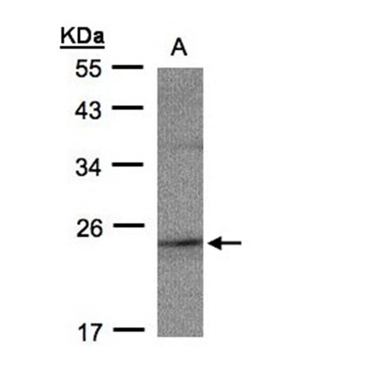 RAP2C antibody from Signalway Antibody (23146) - Antibodies.com