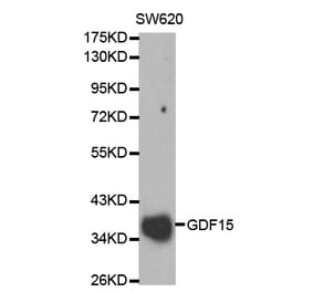 Western blot - GDF15 Antibody from Signalway Antibody (32005) - Antibodies.com