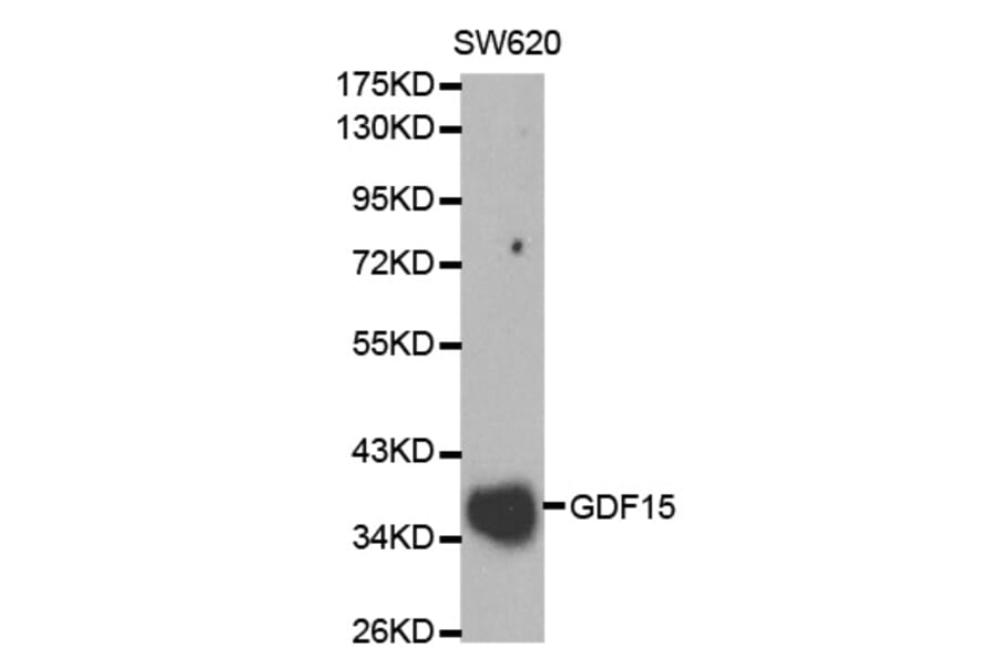 Western blot - GDF15 Antibody from Signalway Antibody (32005) - Antibodies.com