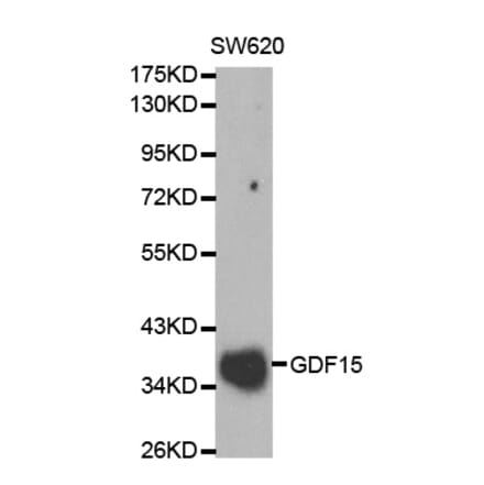Western blot - GDF15 Antibody from Signalway Antibody (32005) - Antibodies.com