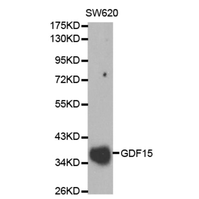 Western blot - GDF15 Antibody from Signalway Antibody (32005) - Antibodies.com