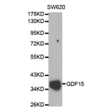 Western blot - GDF15 Antibody from Signalway Antibody (32005) - Antibodies.com