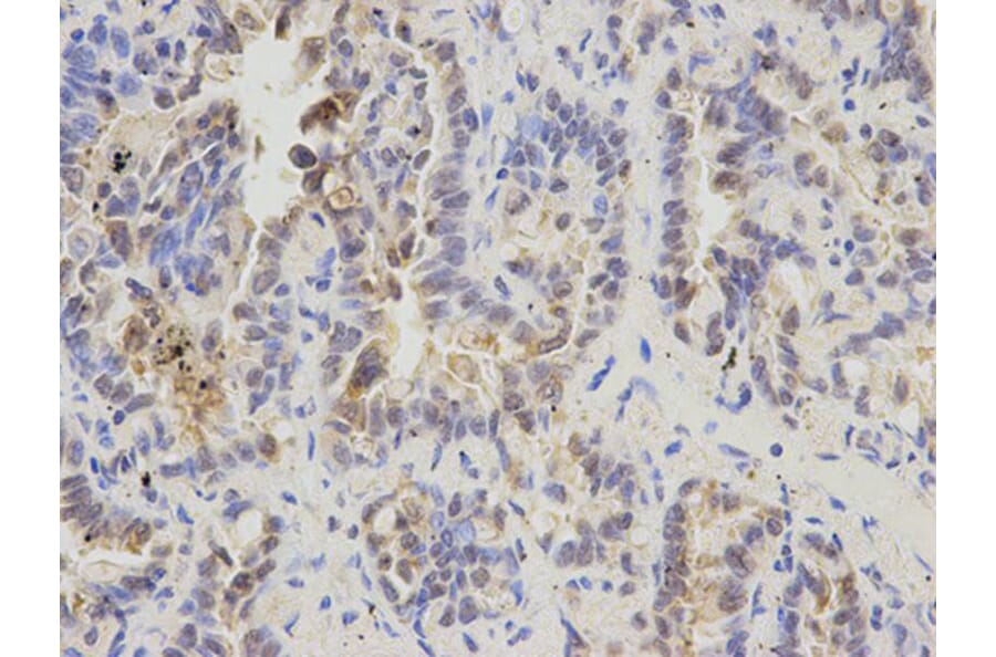 Immunohistochemistry - GDF15 Antibody from Signalway Antibody (32005) - Antibodies.com