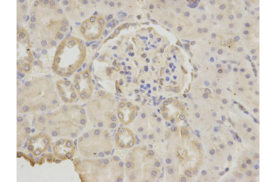 Immunohistochemistry - GDF15 Antibody from Signalway Antibody (32005) - Antibodies.com