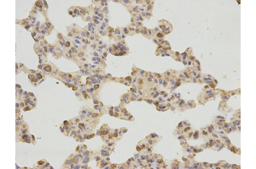 Immunohistochemistry - GDF15 Antibody from Signalway Antibody (32005) - Antibodies.com
