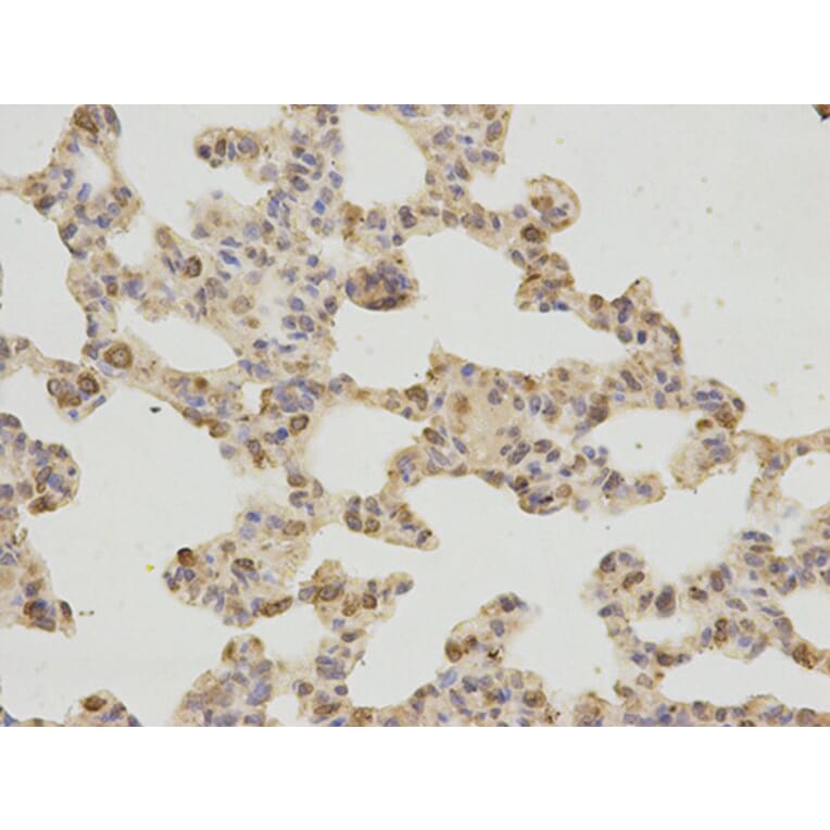 Immunohistochemistry - GDF15 Antibody from Signalway Antibody (32005) - Antibodies.com