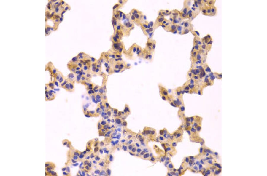Immunohistochemistry - CASP3 Antibody from Signalway Antibody (32018) - Antibodies.com
