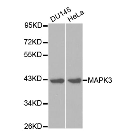 Western blot - MAPK3 Antibody from Signalway Antibody (32027) - Antibodies.com