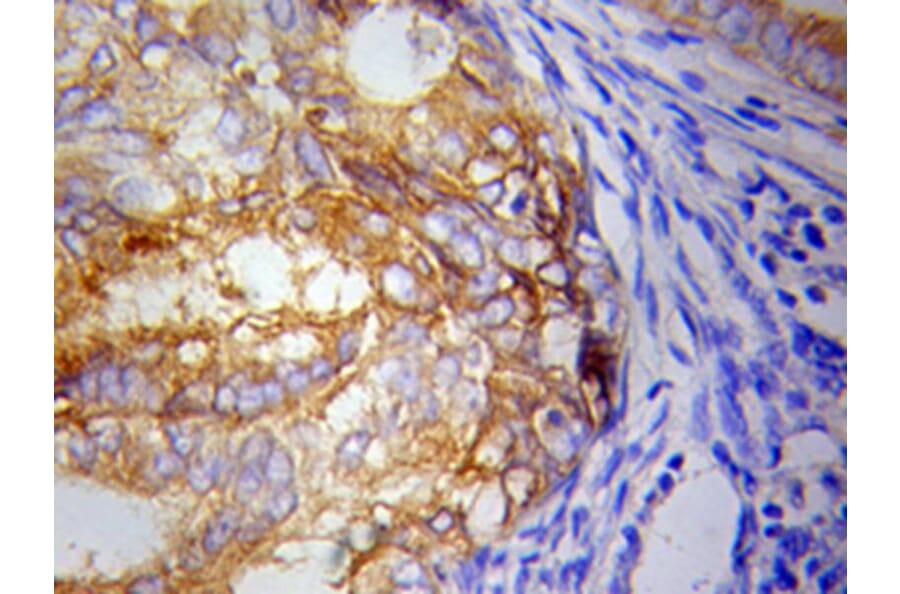 Immunohistochemistry - IKBKE Antibody from Signalway Antibody (32038) - Antibodies.com