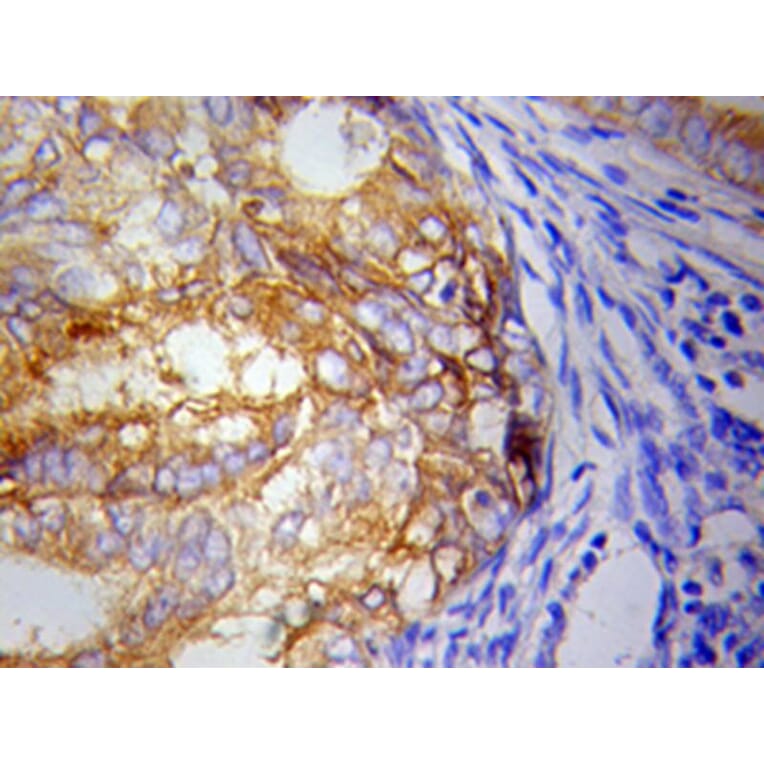 Immunohistochemistry - IKBKE Antibody from Signalway Antibody (32038) - Antibodies.com