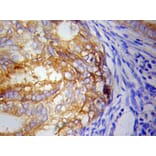 Immunohistochemistry - IKBKE Antibody from Signalway Antibody (32038) - Antibodies.com
