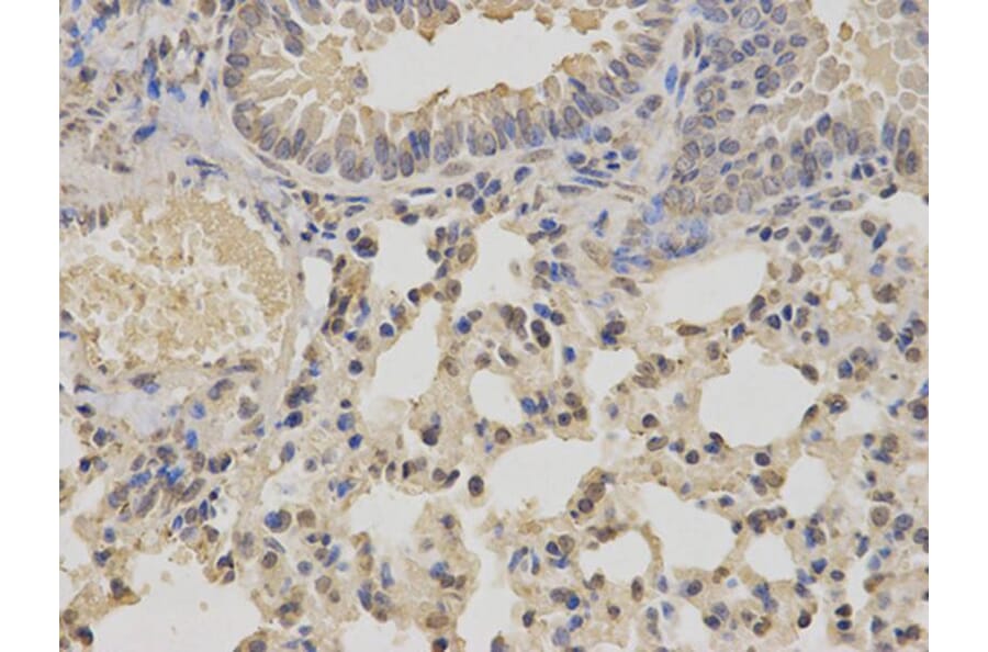 Immunohistochemistry - IKBKE Antibody from Signalway Antibody (32038) - Antibodies.com