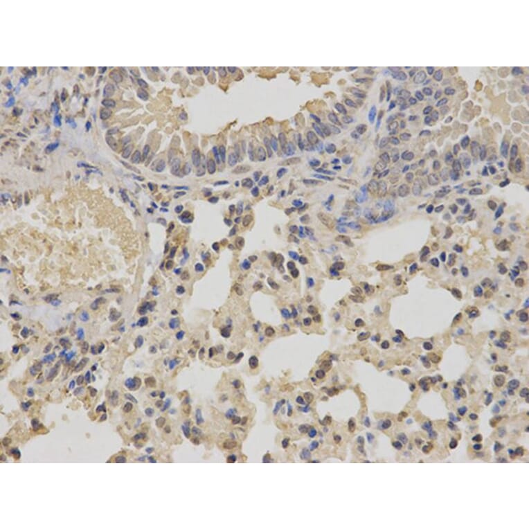 Immunohistochemistry - IKBKE Antibody from Signalway Antibody (32038) - Antibodies.com