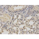 Immunohistochemistry - IKBKE Antibody from Signalway Antibody (32038) - Antibodies.com