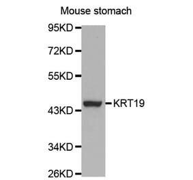 Western blot - KRT19 Antibody from Signalway Antibody (32040) - Antibodies.com