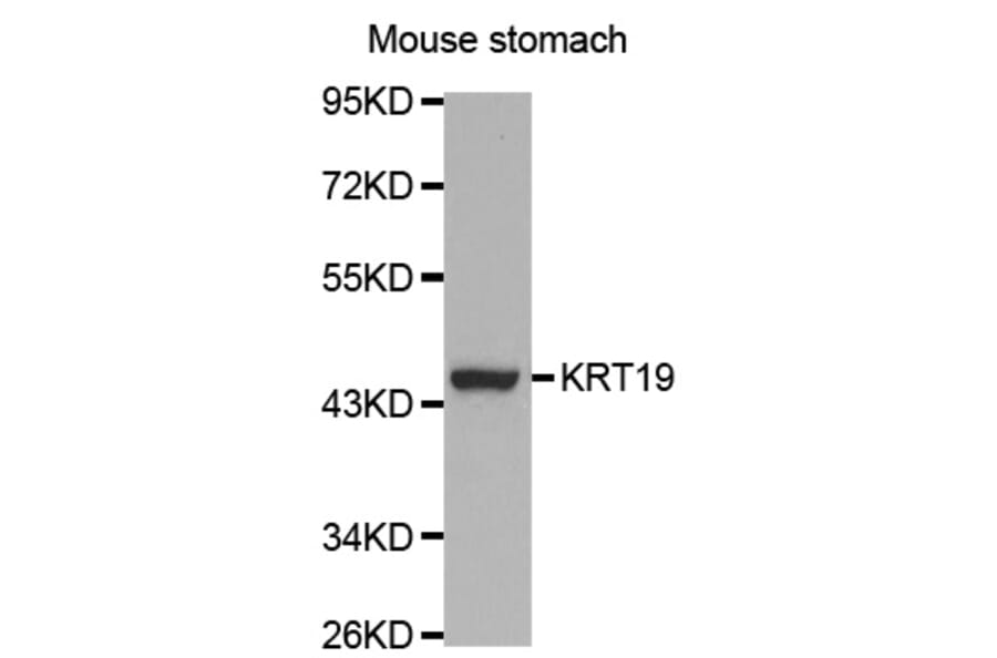 Western blot - KRT19 Antibody from Signalway Antibody (32040) - Antibodies.com