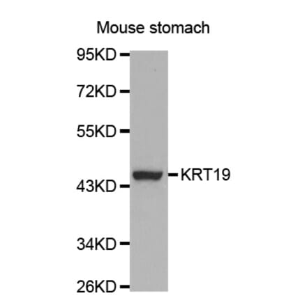 Western blot - KRT19 Antibody from Signalway Antibody (32040) - Antibodies.com