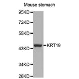 Western blot - KRT19 Antibody from Signalway Antibody (32040) - Antibodies.com