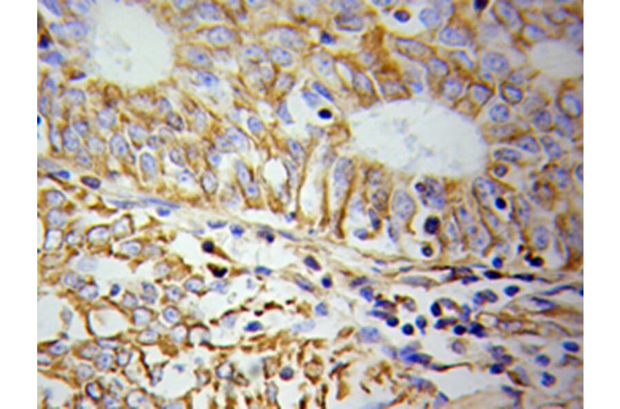 Immunohistochemistry - KRT19 Antibody from Signalway Antibody (32040) - Antibodies.com