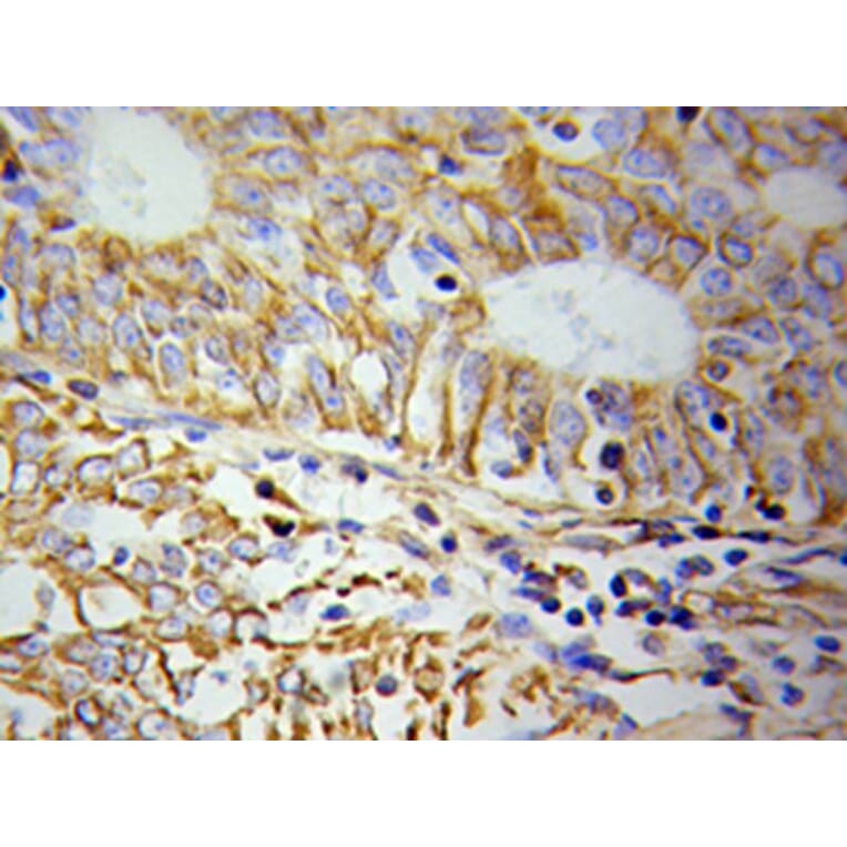 Immunohistochemistry - KRT19 Antibody from Signalway Antibody (32040) - Antibodies.com