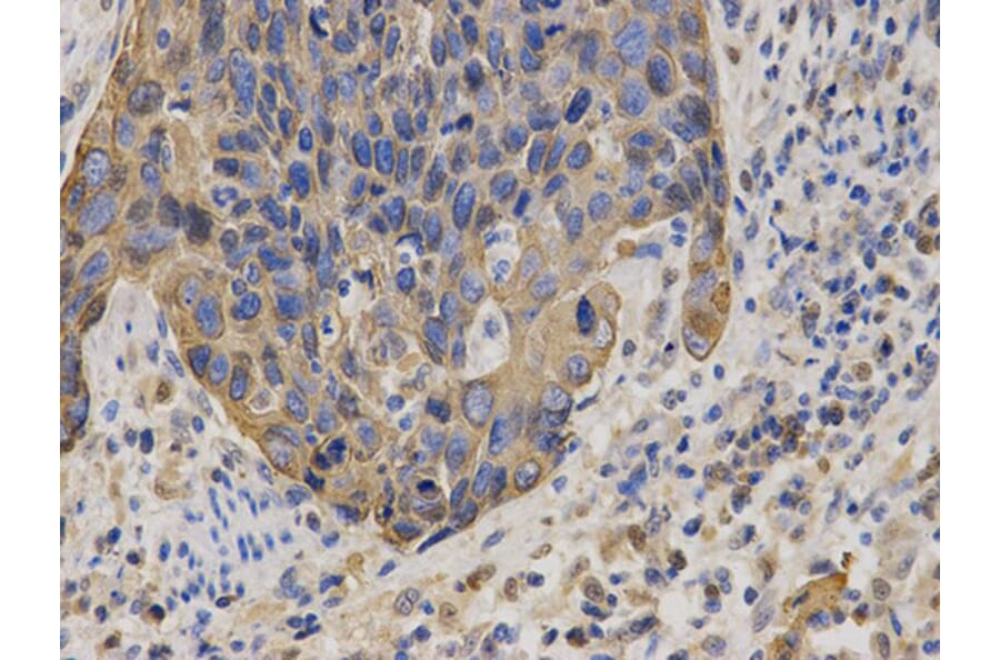 Immunohistochemistry - KRT19 Antibody from Signalway Antibody (32040) - Antibodies.com