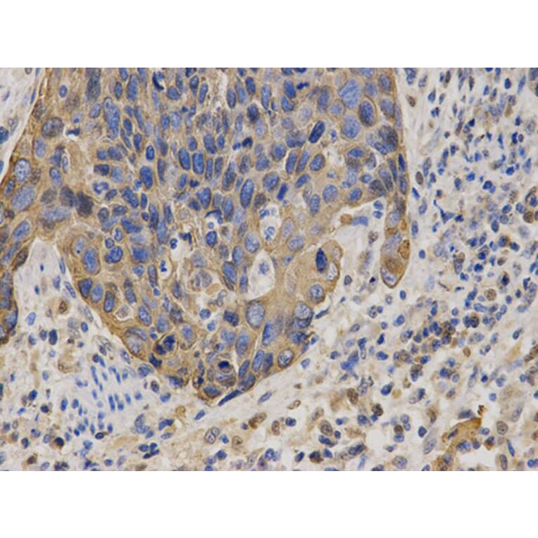 Immunohistochemistry - KRT19 Antibody from Signalway Antibody (32040) - Antibodies.com
