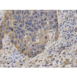 Immunohistochemistry - KRT19 Antibody from Signalway Antibody (32040) - Antibodies.com