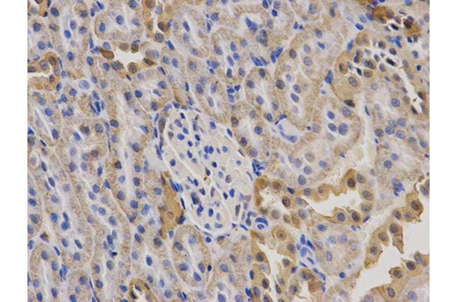 Immunohistochemistry - KRT19 Antibody from Signalway Antibody (32040) - Antibodies.com