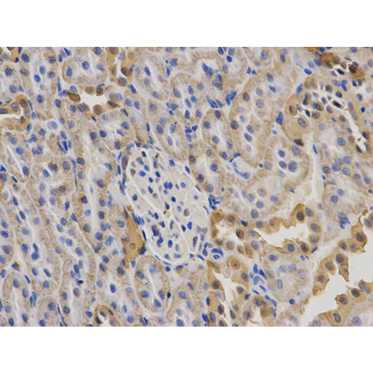 Immunohistochemistry - KRT19 Antibody from Signalway Antibody (32040) - Antibodies.com