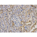 Immunohistochemistry - KRT19 Antibody from Signalway Antibody (32040) - Antibodies.com