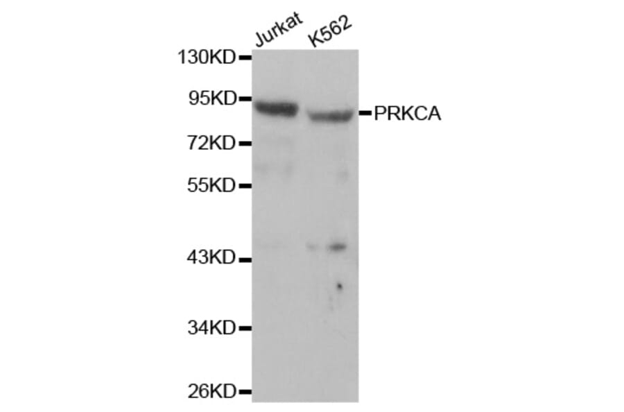Western blot - PRKCA Antibody from Signalway Antibody (32053) - Antibodies.com