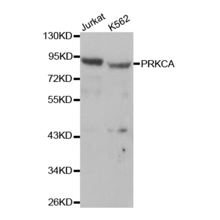 Western blot - PRKCA Antibody from Signalway Antibody (32053) - Antibodies.com